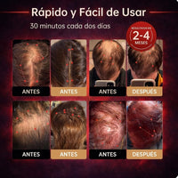 Folix Cap — Gorra con Terapia de Luz Roja